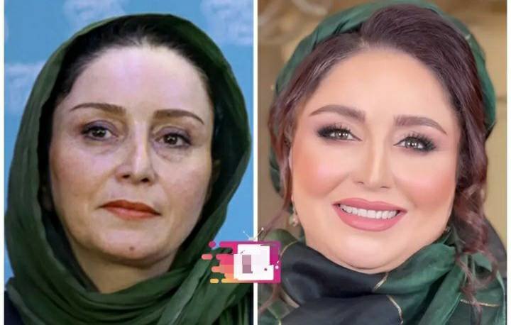 عکس ژاله صامتی قبل از عمل عکس ژاله صامتی قبل از عمل