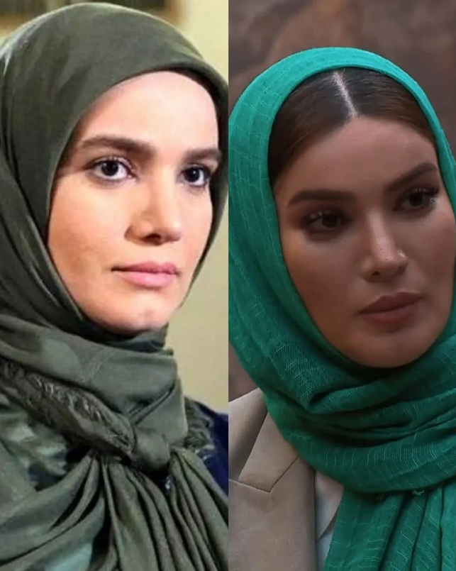 عکس متین ستوده قبل از عمل عکس متین ستوده قبل از عمل