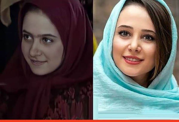 عکس الناز حبیبی قبل از عمل عکس الناز حبیبی قبل از عمل