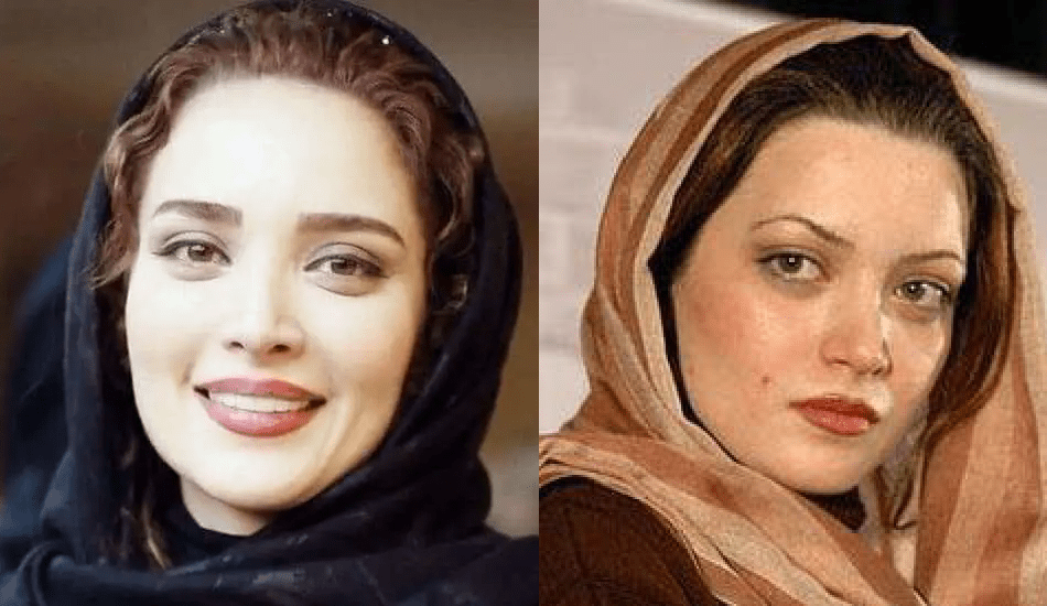 عکس بهنوش طباطبایی قبل از عمل عکس بهنوش طباطبایی قبل از عمل