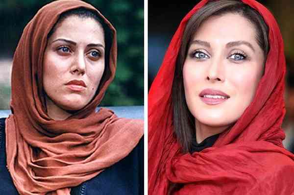 مهتاب کرامتی قبل از عمل عکس مهتاب کرامتی قبل از عمل عکس