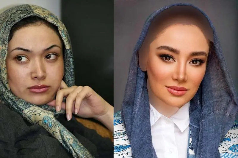 عکس قبل از عمل بهاره افشاری عکس قبل از عمل بهاره افشاری