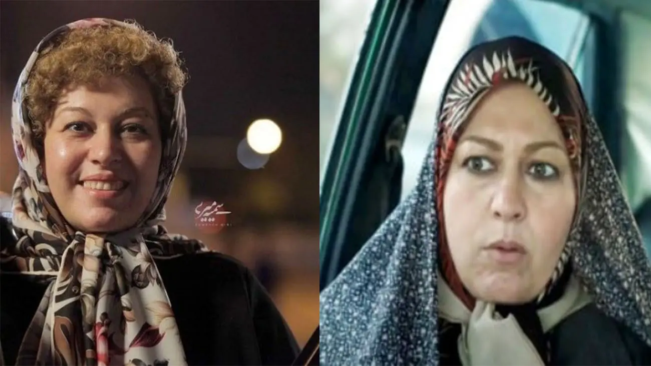 عکس گیتی قاسمی قبل از عمل عکس گیتی قاسمی قبل از عمل